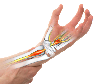 Diagram of wrist, fingers, nerves and tendons