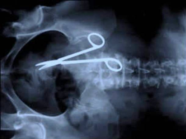 surgical scissors